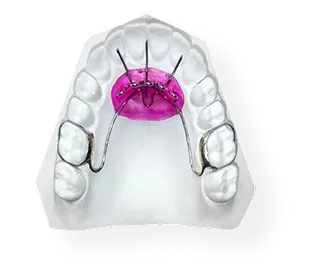 Beggs Retainers