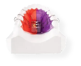 Beggs Retainers